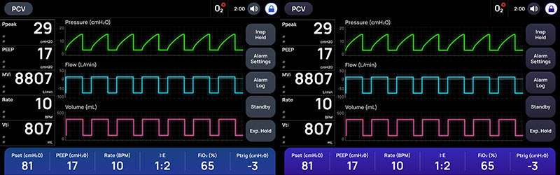 Left: The color scheme we agreed on. Right: The color scheme used in the ventilator’s software.